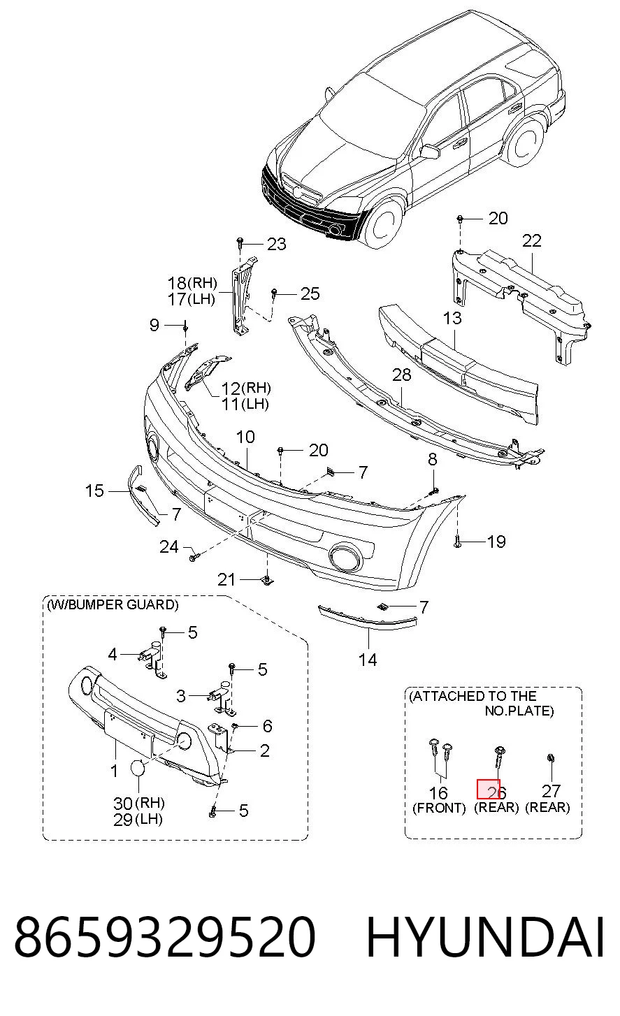 8659329520 Hyundai/Kia 
