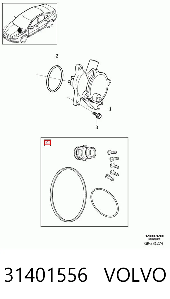 31401556 Volvo Kit de reparação da bomba de vácuo